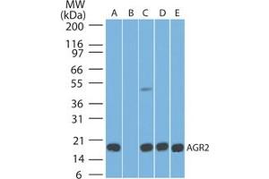 Image no. 1 for anti-Anterior Gradient Homolog 2 (Xenopus Laevis) (AGR2) (AA 50-100) antibody (ABIN1491565) (AGR2 antibody  (AA 50-100))