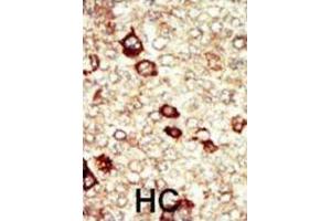 Immunohistochemistry (IHC) image for anti-Fibroblast Growth Factor Receptor 4 (FGFR4) antibody (ABIN2929142) (FGFR4 antibody)