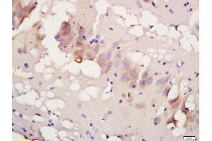 Formalin-fixed and paraffin embedded rat brain labeled with Rabbit Anti-TBK1 (Ser172) Polyclonal Antibody, Unconjugated 1:200 followed by conjugation to the secondary antibody and DAB staining
