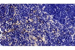 Immunohistochemistry (IHC) image for anti-Caveolin 1, Caveolae Protein, 22kDa (CAV1) (AA 2-104) antibody (ABIN7431323)