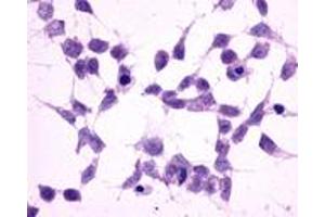 Anti-GRM2 / MGLUR2 antibody immunocytochemistry (ICC) staining of untransfected HEK293 human embryonic kidney cells. (GRM2 antibody  (N-Term))