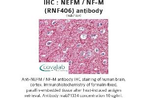 Image no. 1 for anti-Neurofilament Triplet M Protein (NEFM) antibody (ABIN1724427) (NEFM antibody)