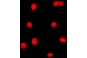 Immunofluorescent analysis of C/EBP gamma staining in Jurkat cells. (CEBPG antibody)
