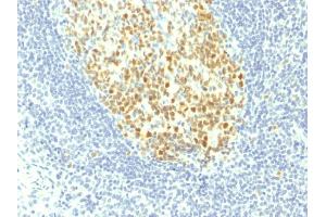 Formalin-fixed, paraffin-embedded human Tonsil stained with MCM7 Mouse Monoclonal Antibody (MCM7/1467). (MCM7 antibody  (AA 195-319))