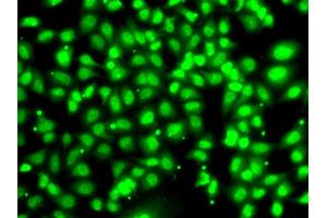 Immunofluorescence analysis of U2OS cells using COPS2 antibody. (COPS2 antibody)