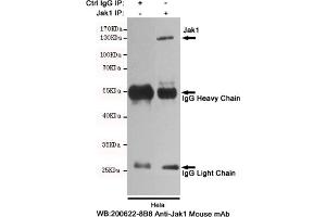 Immunoprecipitation analysis of Hela cell lysates using Jak1 mouse mAb.