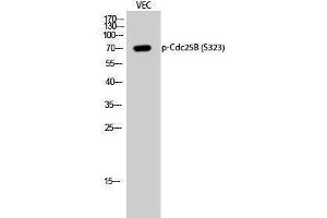 Western Blotting (WB) image for anti-Cell Division Cycle 25 Homolog B (S. Pombe) (CDC25B) (pSer323) antibody (ABIN3181956) (CDC25B antibody  (pSer323))