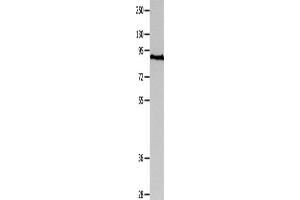Western Blotting (WB) image for anti-Melanoma Antigen Family D, 1 (MAGED1) antibody (ABIN2428383)