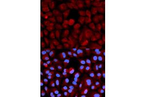 Immunofluorescence (IF) image for anti-Transcription Elongation Factor B (SIII), Polypeptide 2 (18kDa, Elongin B) (TCEB2) antibody (ABIN1876550)