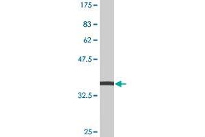 Western Blot detection against Immunogen (38. (JNK antibody  (AA 318-427))