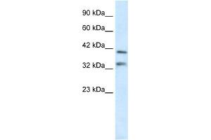 WB Suggested Anti-GSH2 Antibody Titration:  0.