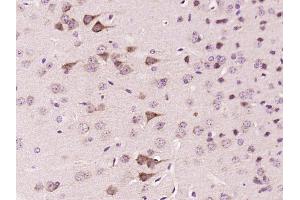 Paraformaldehyde-fixed, paraffin embedded Mouse brain Antigen retrieval by boiling in sodium citrate buffer (pH6. (FSD1 antibody  (AA 421-496))
