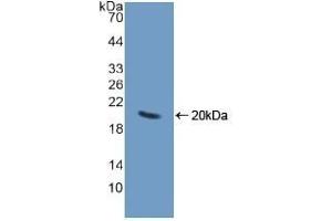 Detection of Recombinant CHGA, Human using Polyclonal Antibody to Chromogranin A (CHGA) (Chromogranin A antibody  (AA 15-148))