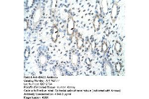 Rabbit Anti-BAG2 Antibody  Paraffin Embedded Tissue: Human Kidney Cellular Data: Epithelial cells of renal tubule Antibody Concentration: 4. (BAG2 antibody  (C-Term))