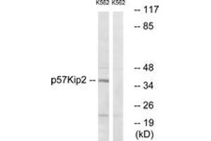 Western Blotting (WB) image for anti-Cyclin-Dependent Kinase Inhibitor 1C (p57, Kip2) (CDKN1C) (AA 267-316) antibody (ABIN2888853) (CDKN1C antibody  (AA 267-316))