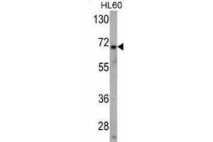 Western Blotting (WB) image for anti-Ubiquitin Specific Peptidase 2 (USP2) antibody (ABIN3001464) (USP2 antibody)