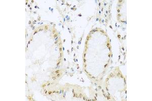 Immunohistochemistry of paraffin-embedded human stomach using PGR antibody at dilution of 1:100 (x40 lens). (Progesterone Receptor antibody)