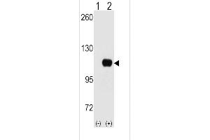 Western blot analysis of HK1 (arrow) using HK1 Antibody (C-term) (ABIN392760 and ABIN2842211).