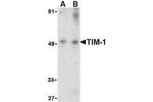 Western Blotting (WB) image for anti-Hepatitis A Virus Cellular Receptor 1 (HAVCR1) (Center) antibody (ABIN2476808) (HAVCR1 antibody  (Center))
