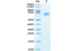 Human NOGOR on Tris-Bis PAGE under reduced condition. (Reticulon 4 Protein (RTN4) (AA 27-447) (His tag))