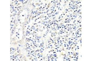 Immunohistochemistry of paraffin-embedded Human appendix using FKBP5 Polyclonal Antibody at dilution of 1:100 (40x lens). (FKBP5 antibody)