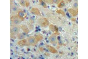Used in DAB staining on fromalin fixed paraffin-embedded Liver tissue (FGF23 antibody  (AA 25-251))