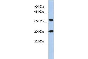 WB Suggested Anti-C22orf25 Antibody Titration: 0. (C22orf25 antibody  (N-Term))