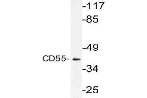 Western blot (WB) analysis of CD55 antibody in extracts from Jurkat cells. (CD55 antibody)