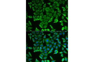 Immunofluorescence analysis of MCF-7 cells using RARS antibody (ABIN6127449, ABIN6146708, ABIN6146709 and ABIN6221913). (RARS antibody  (AA 1-300))