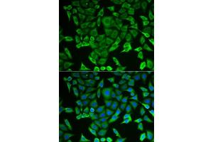Immunofluorescence analysis of MCF-7 cells using RARS antibody (ABIN6127449, ABIN6146708, ABIN6146709 and ABIN6221913). (RARS antibody  (AA 1-300))