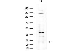 Western blot analysis of lysates from COLO205 cells(heat-shock treatment), using MRPS26 Antibody at 1/1000 dilution.