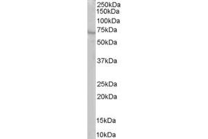 ABIN185305 staining (1µg/ml) of human brain lysate (RIPA buffer, 35µg total protein per lane). (RIC8A antibody  (C-Term))