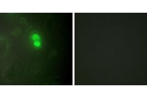 Peptide - +Western blot analysis of extracts from HeLa cells, using Dyskerin antibody. (DKC1 antibody  (Internal Region))