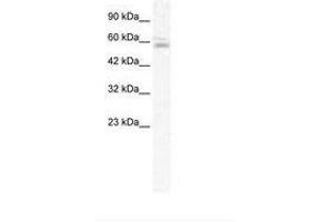 Image no. 1 for anti-Zinc Finger Protein 141 (ZNF141) (AA 143-192) antibody (ABIN202617) (ZNF141 antibody  (AA 143-192))