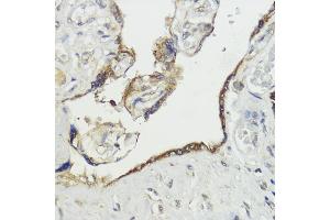 Immunohistochemistry of paraffin-embedded human placenta using H antibody (ABIN7267593) at dilution of 1:100 (40x lens). (HACE1 antibody  (AA 1-100))