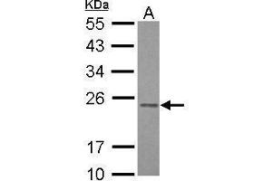 WB Image Sample (30 ug of whole cell lysate) A: HepG2 12% SDS PAGE antibody diluted at 1:1000 (RAB3B antibody)
