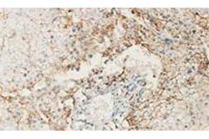 Immunohistochemical staining of formalin-fixed paraffin-embedded human fetal liver showing staining with ANXA6 polyclonal antibody  at 1:100 dilution. (ANXA6 antibody)