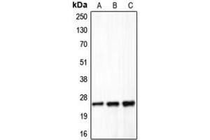 Western blot analysis of Claudin 5 expression in HeLa (A), mouse liver (B), rat lung (C) whole cell lysates.