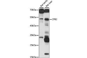 Western blot analysis of extracts of various cell lines, using CPB2 antibody (ABIN7266081) at 1:1000 dilution. (CPB2 antibody  (AA 310-410))