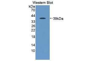 Western blot analysis of the recombinant protein. (CCL19 antibody  (AA 159-258))