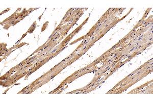 Detection of AST2 in Rat Cardiac Muscle Tissue using Polyclonal Antibody to Aspartate Aminotransferase 2 (AST2) (GOT2 antibody  (AA 30-430))
