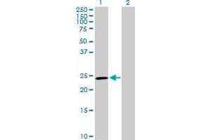 Western Blot analysis of GSTM5 expression in transfected 293T cell line by GSTM5 MaxPab polyclonal antibody. (GSTM5 antibody  (AA 1-218))