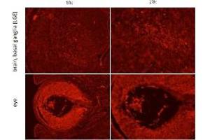 Immunohistochemistry of Rabbit anti-Six-3 antibody Immunohistochemistry of Rabbit anti-Six-3 antibody. (SIX3 antibody  (Internal Region))