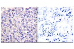 Immunohistochemistry (IHC) image for anti-Transforming Growth Factor, beta 3 (TGFB3) (Internal Region) antibody (ABIN1848798) (TGFB3 antibody  (Internal Region))