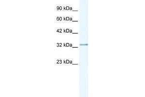 NUDT9 antibody used at 1. (NUDT9 antibody)