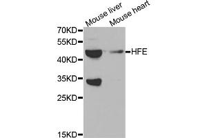 Western blot analysis of extracts of various cell lines, using HFE antibody. (HFE antibody)