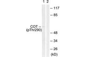 Western blot analysis of extracts from 293 cells treated with UV 15', using COT (Phospho-Thr290) Antibody. (CROT antibody  (pThr290))