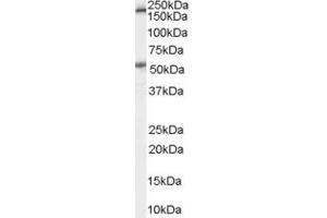 Western Blotting (WB) image for anti-Serotonin Receptor 3A (HTR3A) (Internal Region) antibody (ABIN2466257) (Serotonin Receptor 3A antibody  (Internal Region))