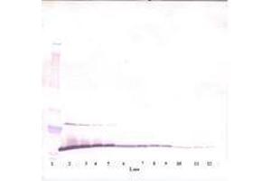 Image no. 2 for anti-Melanoma Inhibitory Activity (MIA) antibody (ABIN464852) (MIA antibody)
