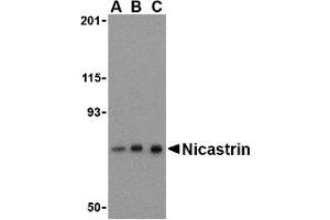 Western Blotting (WB) image for anti-Nicastrin (NCSTN) (C-Term) antibody (ABIN1030543)